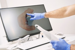 Zahnarzt zeigt auf Teil eines 3D-Scans an einem Bildschirm mit einem Intraoralscanner in der Hand